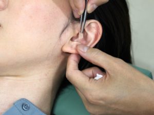 耳鍼ダイエット大阪市阿倍野区旭町東洋スリム藤岡鍼灸院　リバウンドしにくいダイエット