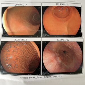 大阪天王寺阿倍野の耳針専門鍼灸院
耳つぼダイエット東洋スリム 藤岡鍼灸院天王寺あべの店
大阪、あべの天王寺でダイエットするなら東洋スリムへ。
痩身エステサロン、パーソナルトレーニングジム、ヨガ、ピラティス、肥満外来、GLP1、マンジャロ、耳つぼジュエリーなどで痩せれなかった方こそどうぞ。天王寺駅近く歩いて3分です。難波、梅田からも御堂筋線で便利です。